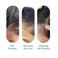 Rosemary Hair Growth Serum Roll On 25 ml – 3% Rosemary, 3% Redensyl & 2% Anagain | DHT-Blocking Scalp Serum Boosts Oxygen Flow, Reduces Hair Fall | Paraben/Sulfate-Free | Women & Men