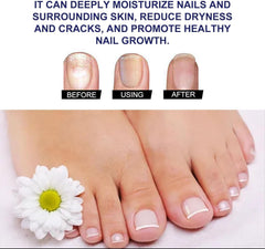 Ginger Nail Treatment Nail Support Nail Care